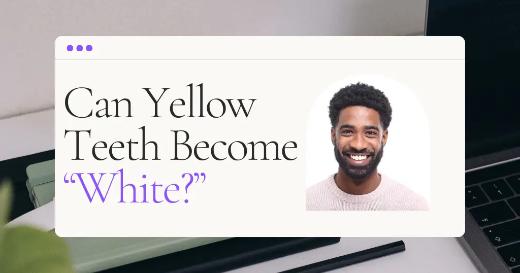 Yellow Teeth White Blog Header