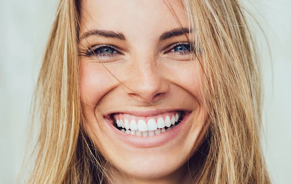 Woman Smiling After Cosmetic Bonding Treatment At élan Tulsa Cosmetic Dentistry In Tulsa, Oklahoma