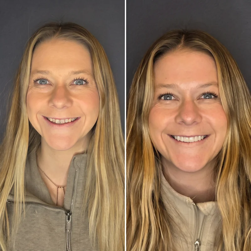 Cosmetic Dentistry Patient Before And After 3