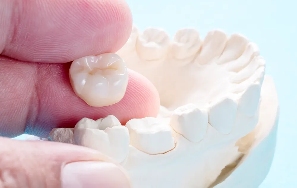 Dental Crown Treatment At élan Tulsa Cosmetic Dentistry In Tulsa, Oklahoma