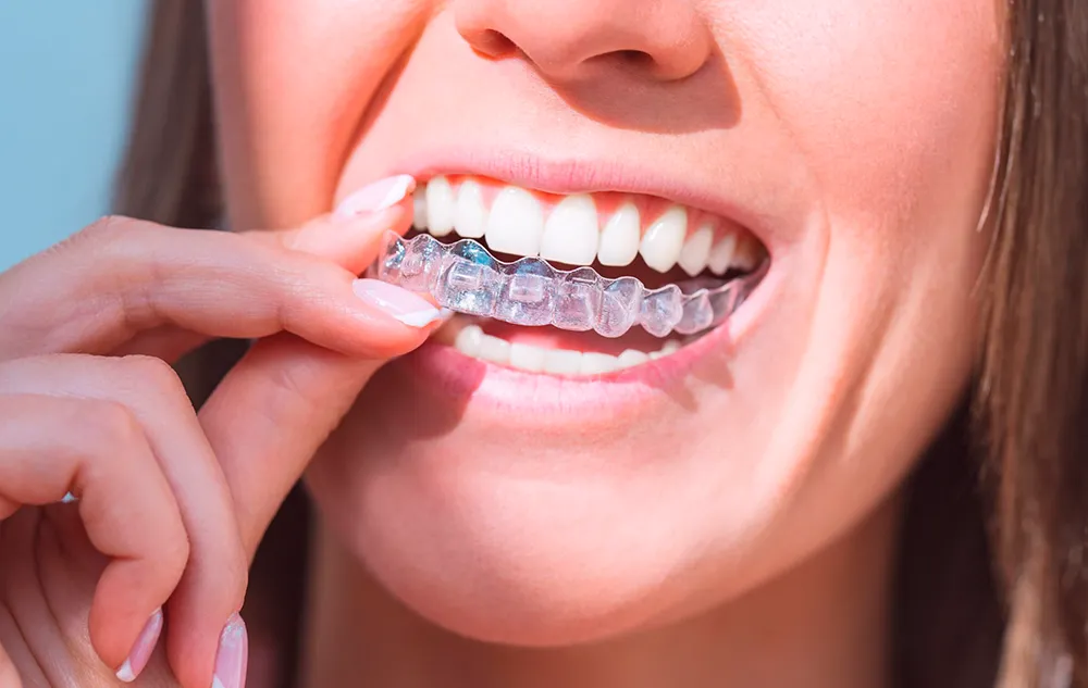 Invisalign Treatment Benefits At élan Tulsa Cosmetic Dentistry In Tulsa, Oklahoma