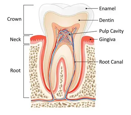 Root Canal Therapy Illustration At élan Tulsa Cosmetic Dentistry In Tulsa, Oklahoma