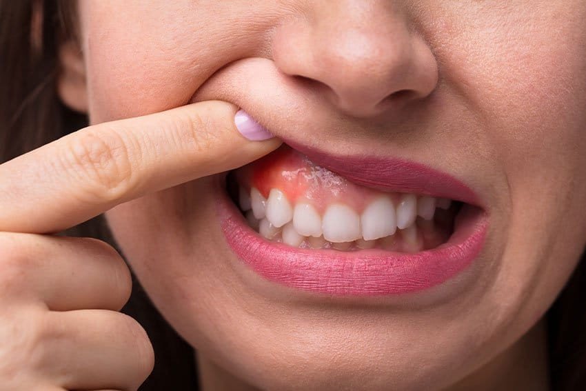 Gum-Disease-Linked-to-Other-Serious-Health-Risks