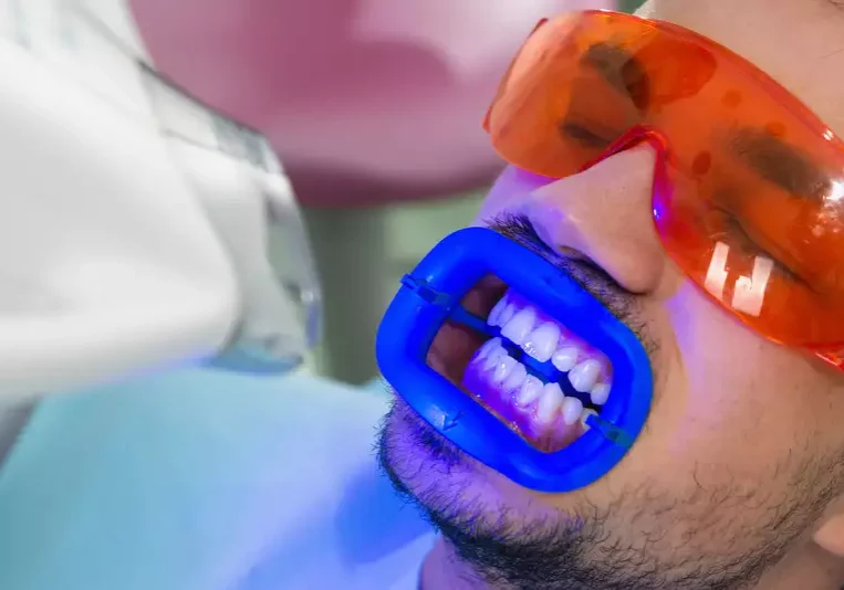 Zoom Teeth Whitening Patient